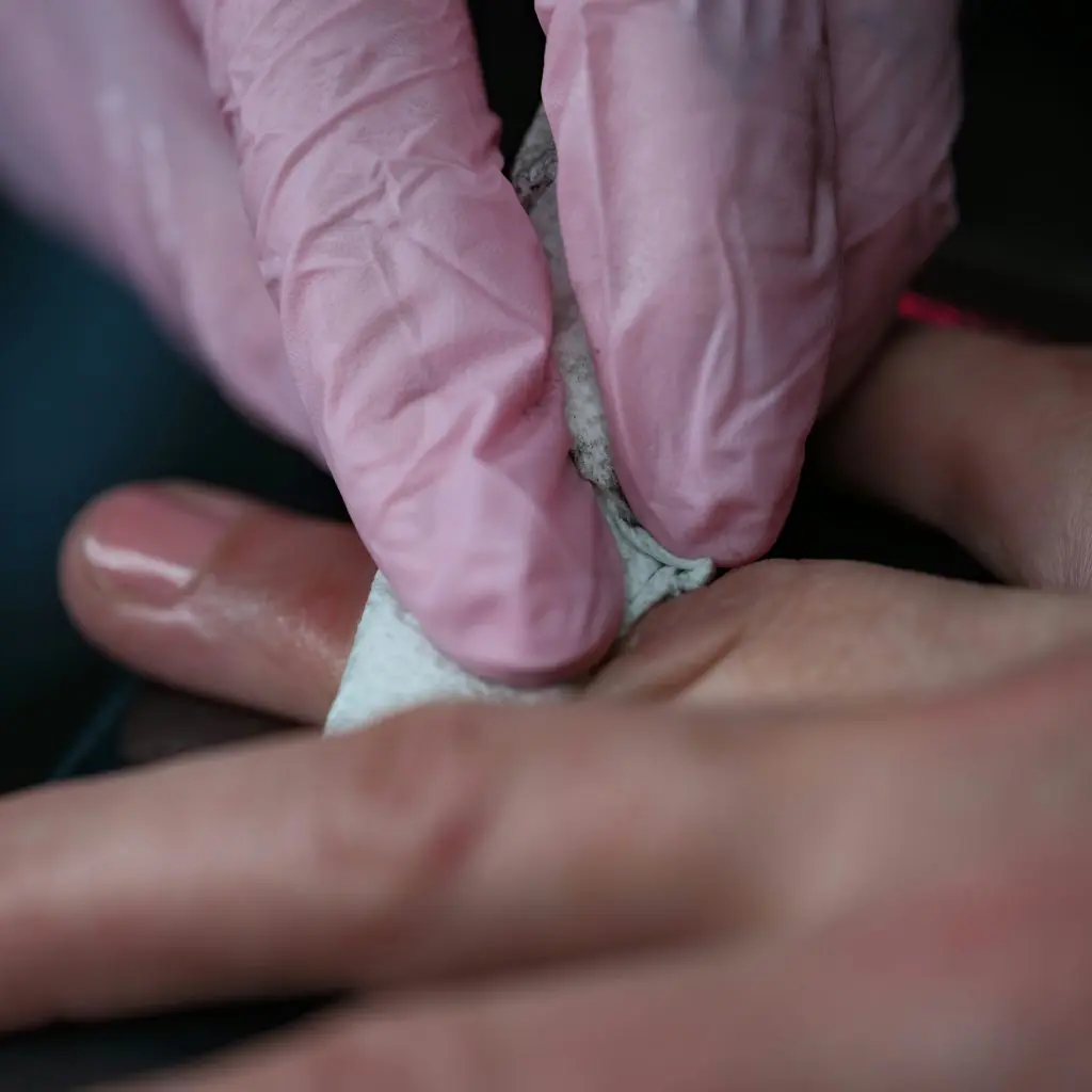chronic wound caregiving check